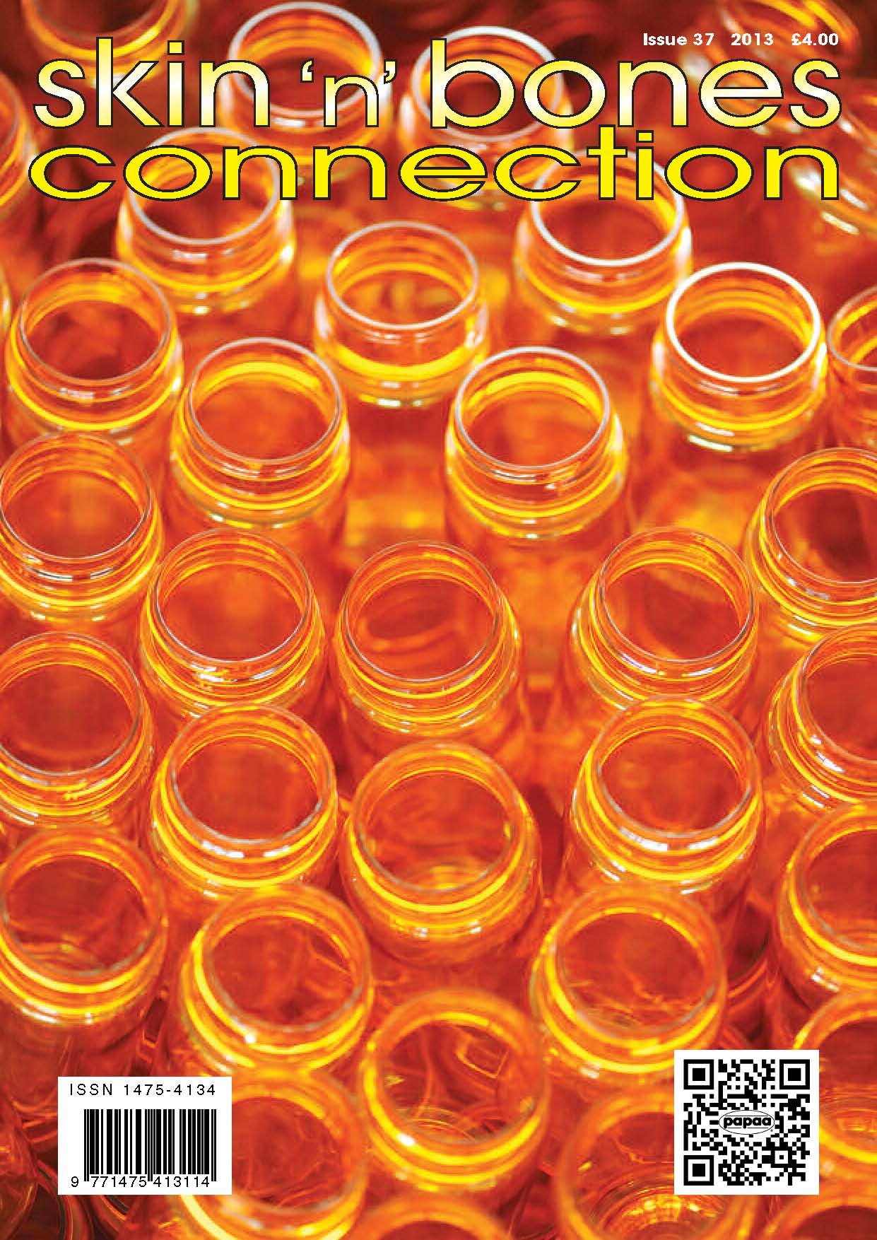 Isotretinoin & Bone Health: The Shocking Acutane Green Bones Connection? - kdd303a
