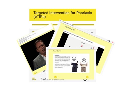 Etips Review E-Tips Course - Psoriasis and Psoriatic Arthritis Alliance (PAPAA)