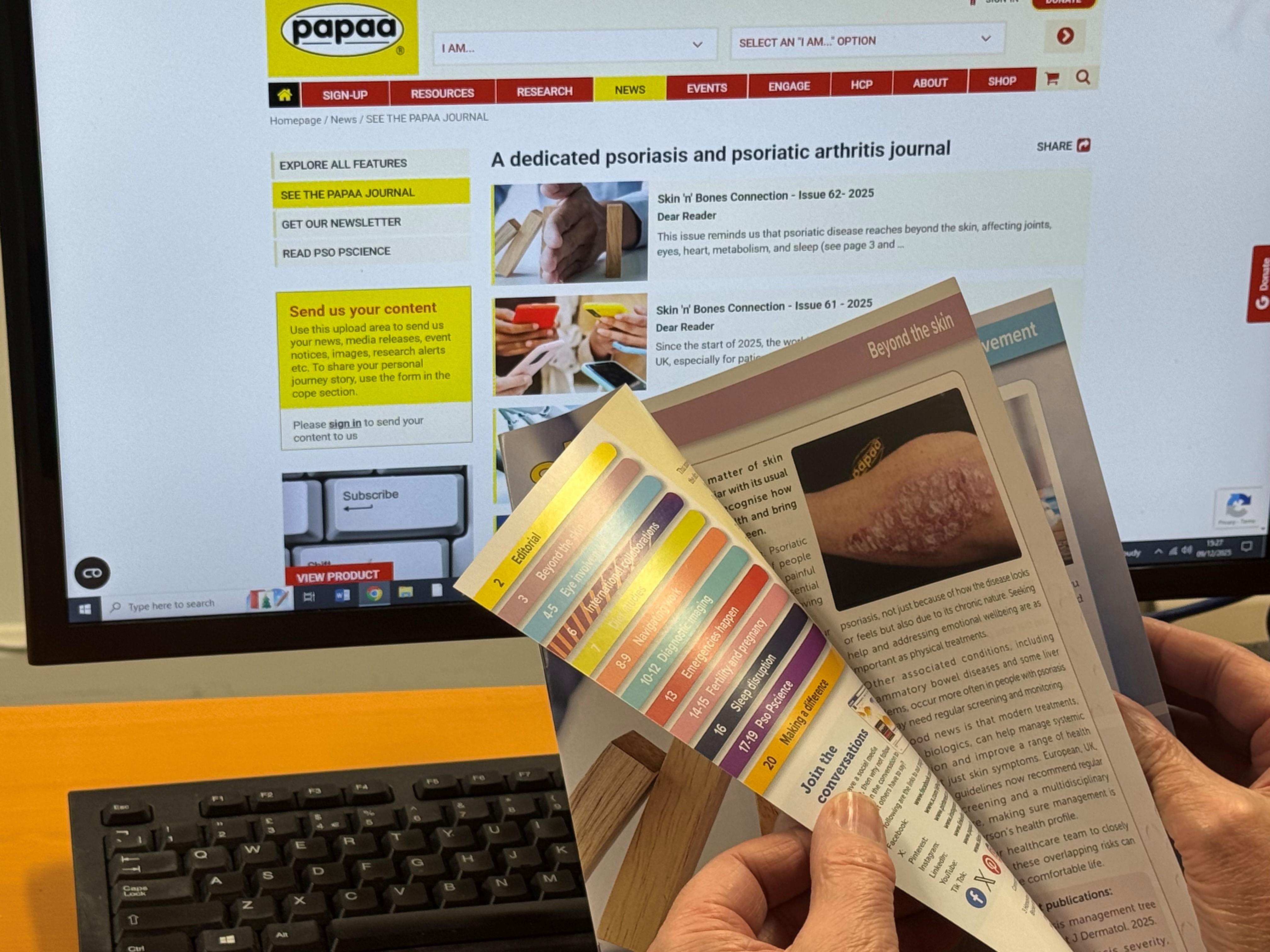 Skin N Bones Connection 62 2025