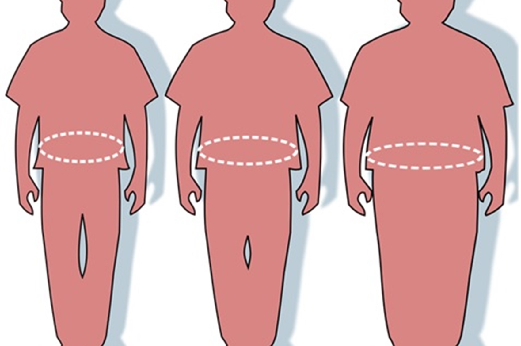 Overweight and psoriasis.jpg