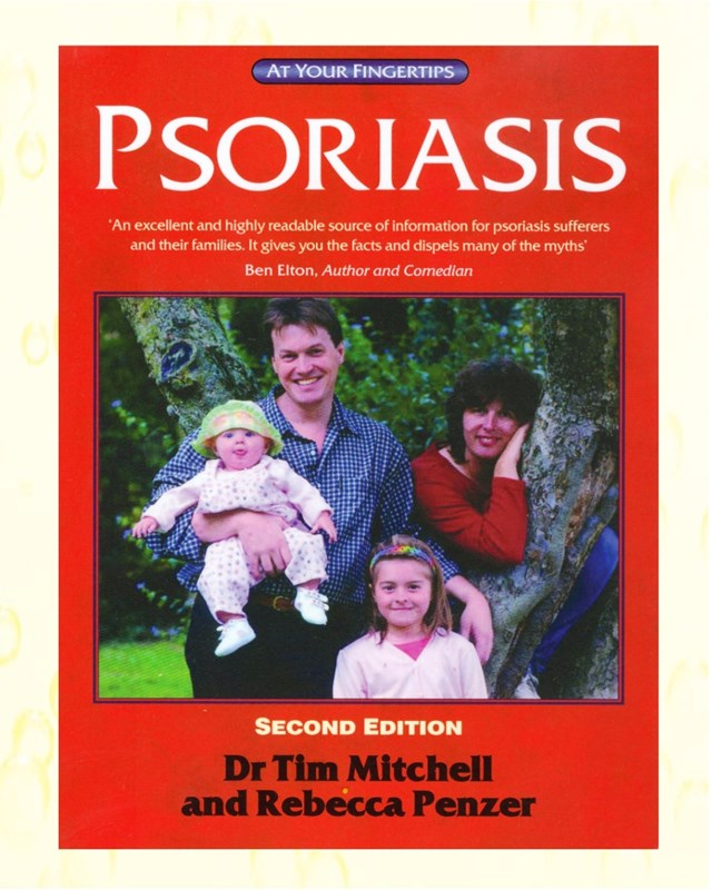 Psoriasis At Your Fingertips Psoriasis And Psoriatic Arthritis