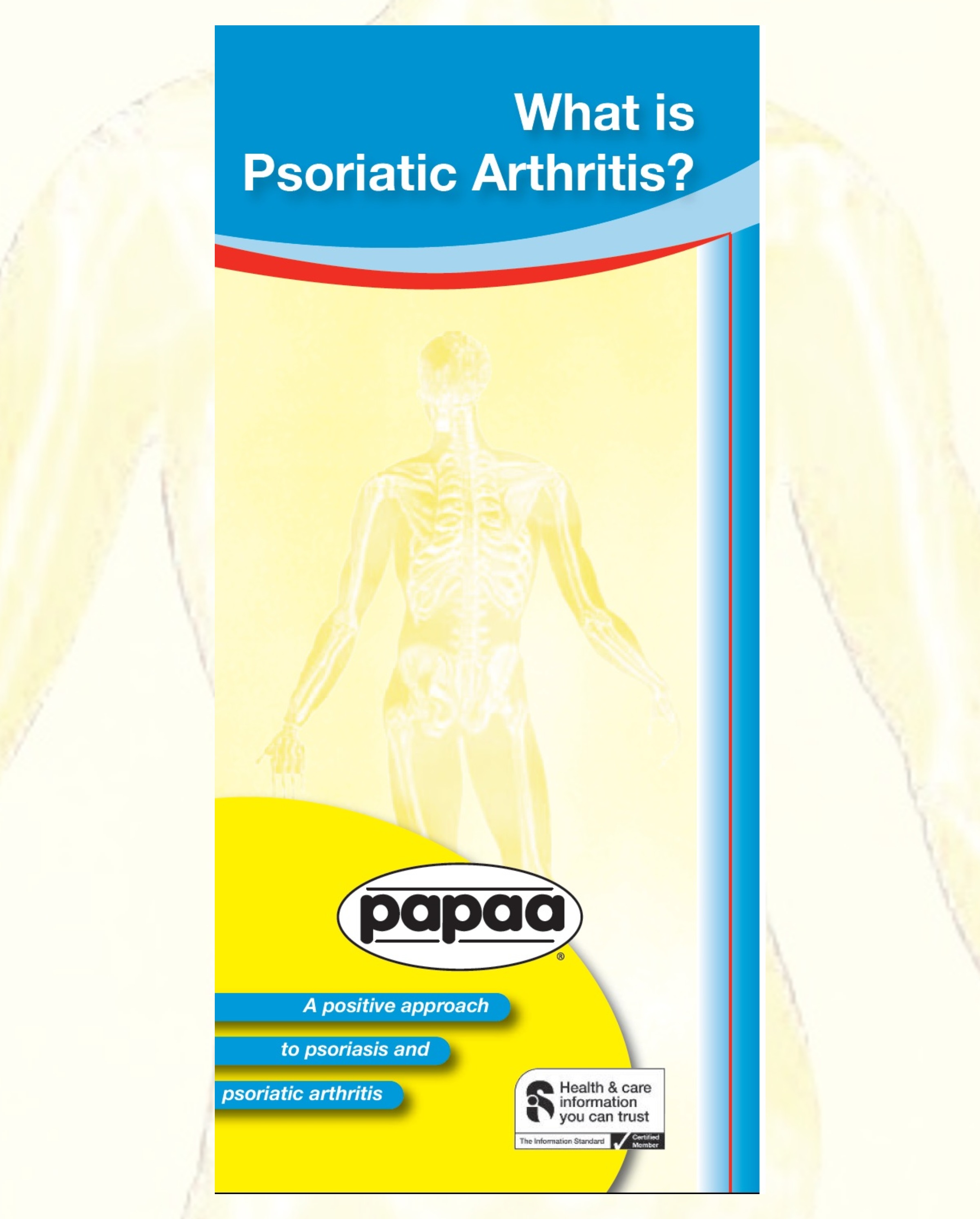 Psoriatic Arthritis Is An Inflammatory Joint Condition Associated With